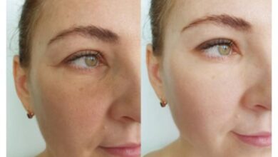 How Can I Find A Qualified Botox Injector In Tucson