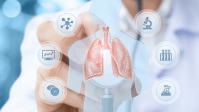 Lung Cancer