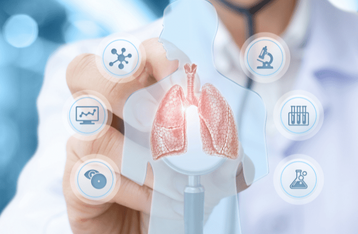 Lung Cancer